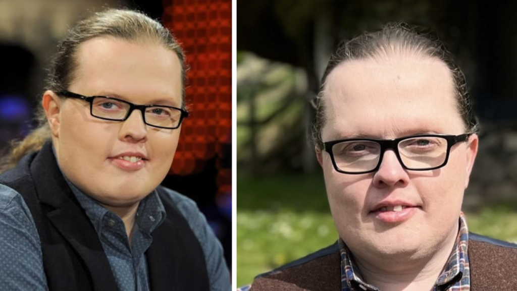 Angelo Kelly Todesursache – Fakten, Hintergründe und die Wahrheit hinter den Gerüchten